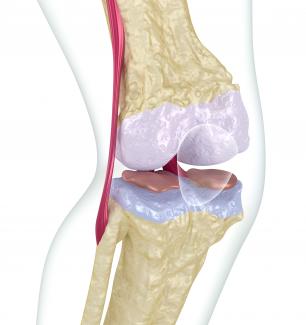 Stock image of osteoporotic bone