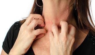 A woman scratching her neck to signify skin allergies