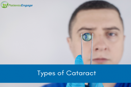 A healthcare professional examining a lens and text overlay on blue strip: Types of Cataract