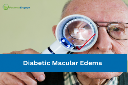 Stock pic or a person looking at a magnifying glass and text overlay Diabetic Macular Edema and PatientsEngage