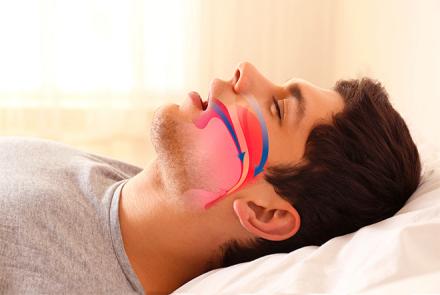 Image of a person snoring and sleeping with demonstrations of airways being affected