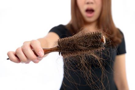 Image shows a women holding a brush with clumps of hair during PCOS