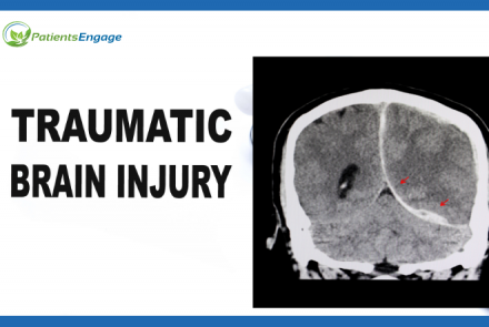 Image of an injured brain and text Traumatic Brain Injury