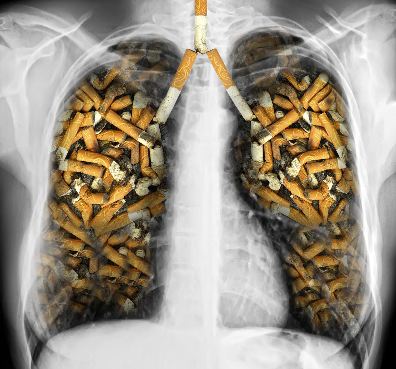 is it bad to smoking cigarettes Risk higher - Study Impact of Smoking on Halitosis