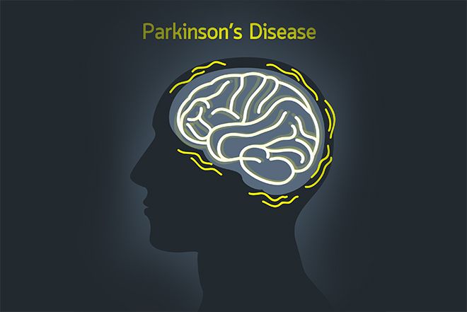 Recognizing Non-Motor Symptoms of Parkinson’s| PatientsEngage