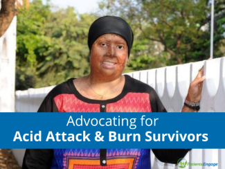 Picture of Pragya Prasun Singh, an acid attack survivor and text overlay on blue strip Advocating for Acid Attack and Burn Survivors 