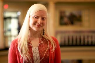 A young woman who has white skin and light hair due to Albinism and in a red shirt