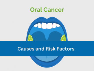 Oral Cancer Causes and Risk Factors