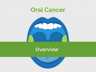 Oral Cancer Overview