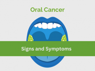 Oral Cancer Signs and Symptoms