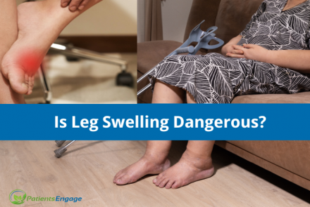 Stock image of woman with swelling in legs and an inset image of swelling in feet. Overlay of blue strip  with the text Is Leg Swelling Dangerous