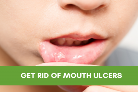 Stock pic of a person with mouth ulcer and a green band with white font and text that says Get Rid Of Mouth Ulcers