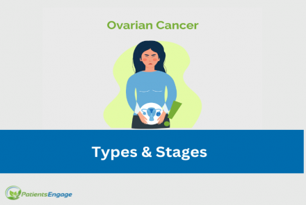 Ovarian Cancer Types Stages