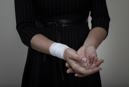 Image of a person seen partially in black dress and with bandaged wrist