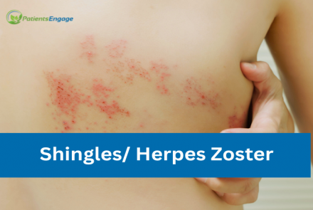 Stock pic of a back with red rashes and text overlay shingles herpes zoster 