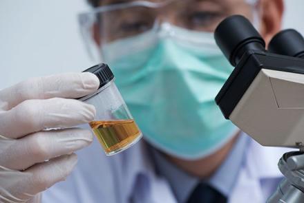 A pathologist with a mask covering his face holding a urine sample bottle