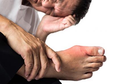 Image: A man looking at his foot which has gout symptoms